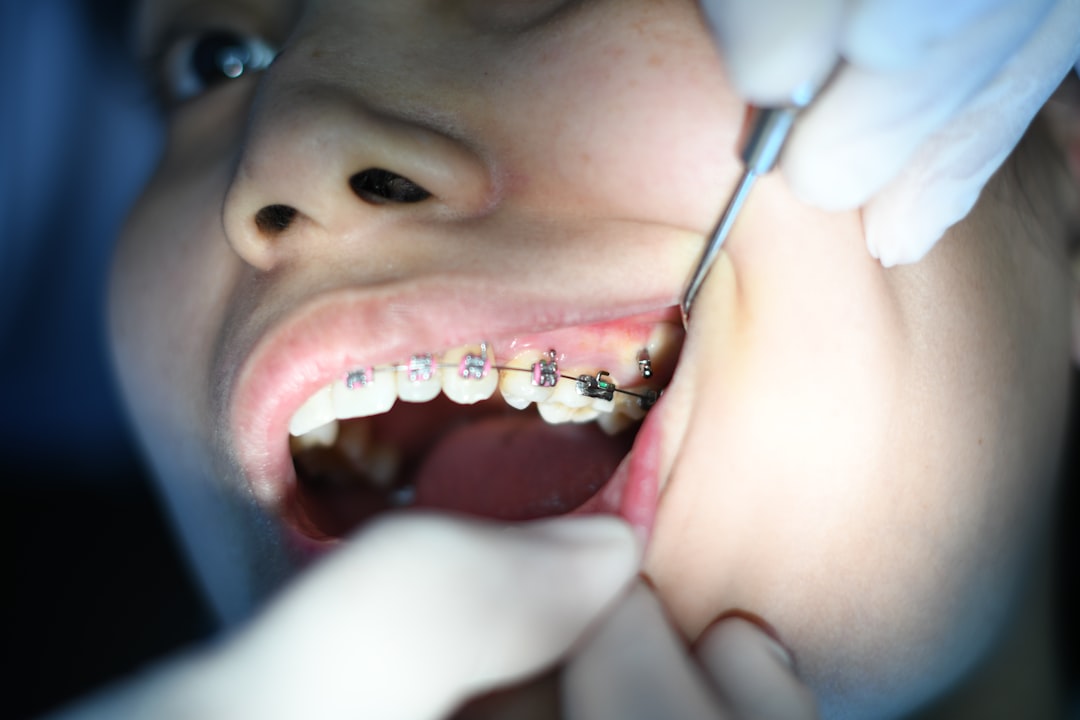 Photo Dental braces